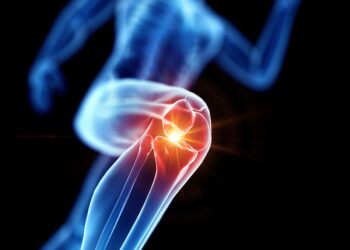 Heb jij last van knakkende knieën? Dít kunnen de oorzaken zijn