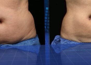 LET OP: Dit populaire drankje helpt je om binnen enkele weken van buikvet af te komen