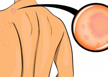 9 waarschuwingssignalen van ons lichaam die je absoluut serieus moeten nemen