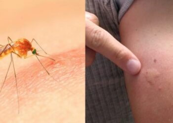 Via deze truc zorg jij ervoor dat geen enkele mug jou ooit meer steekt