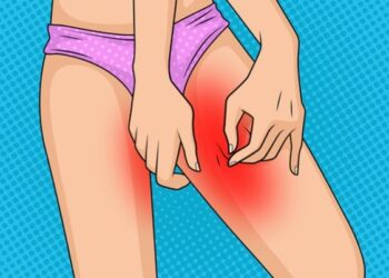 Schurende bovenbenen in de zomer voorkom je met deze simpele truc