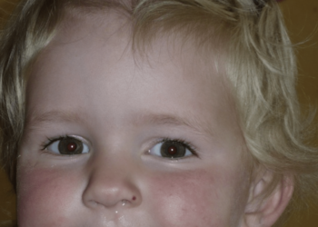 Anoniem: “De schoolfoto is verschrikkelijk! De juf had beter moeten kijken”