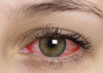 5 manieren waarop je ogen je waarschuwen voor gevaarlijke gezondheidsproblemen