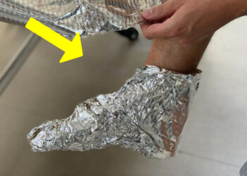 3 dingen die met je gezondheid gebeuren als je aluminiumfolie om je voeten wikkelt