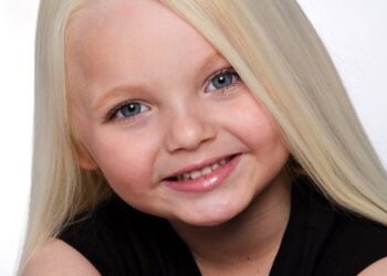 Ze werd gezien als levensechte pop toen ze nog maar 2 jaar was. Kijk hoe ze er nu uitziet