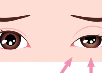 Oogarts waarschuwt: Dit is de rechte reden dat je soms last hebt van een trillend ooglid