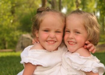 Het verhaal van siamese tweeling Kendra en Malia: Een leven na de scheiding