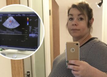 Vrouw lukt het 8 jaar lang niet om zwanger te worden. Als dokter echo maakt valt ze flauw