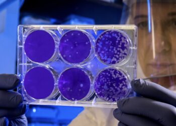 ‘Een DNA-test bracht de 22-jarige affaire van mijn man met mijn moeder aan het licht’