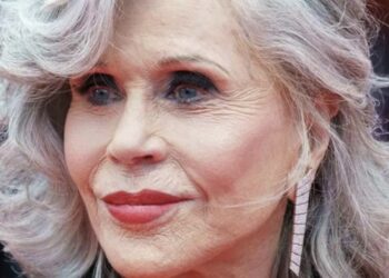 Van Hollywood-icoon naar onherkenbare actrice door cosmetische ingrepen