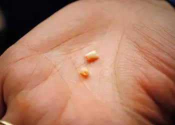 Bewaar melktandjes van je kind altijd! De reden is belangrijker dan je zou denken