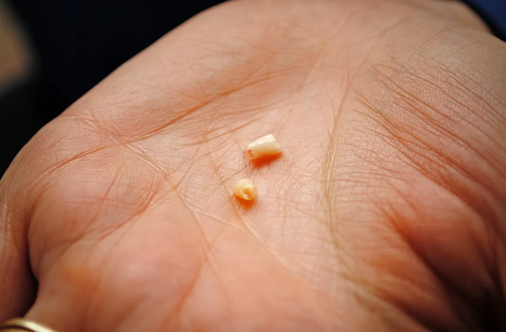 Bewaar melktandjes van je kind altijd! De reden is belangrijker dan je zou denken