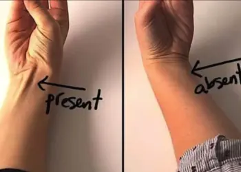 Is er een pees zichtbaar als je met je duim je pink aanraakt? Dit betekent het!