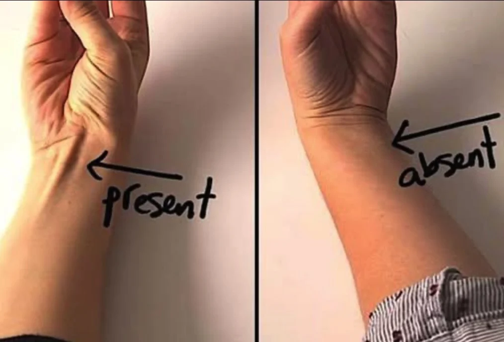 Is er een pees zichtbaar als je met je duim je pink aanraakt? Dit betekent het!