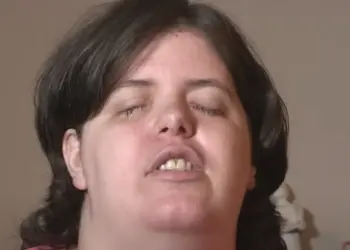 Vrouw maakt zichzelf opzettelijk blind met gootsteenontstopper om droom waar te maken: “Ik had vanaf mijn geboorte blind moeten zijn”