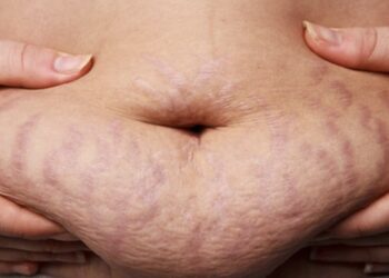 Dit drankje kan helpen om binnen enkele weken van je buikvet af te komen