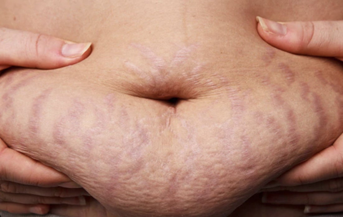 Dit drankje kan helpen om binnen enkele weken van je buikvet af te komen