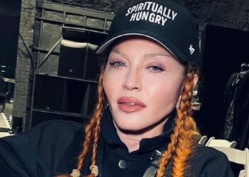Queen of Pop Madonna ondergaat totale gezichtsverandering: ‘Alle fillers opgelost!’