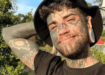 Jonge vader laat 200 tatoeages verwijderen voor zijn dochtertje: “Wat een verschil!”