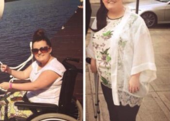 Vrouw heeft jarenlang last van heftig opgezette voeten voor arts de schokkende oorzaak bekend maakt