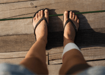 Artsen waarschuwen: dit is wat slippers tijdens een vakantie echt met je doen