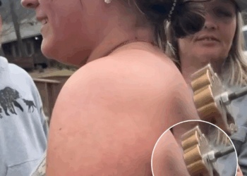 Vrouw geeft geen krimp bij het vriesmerken van haar rug…