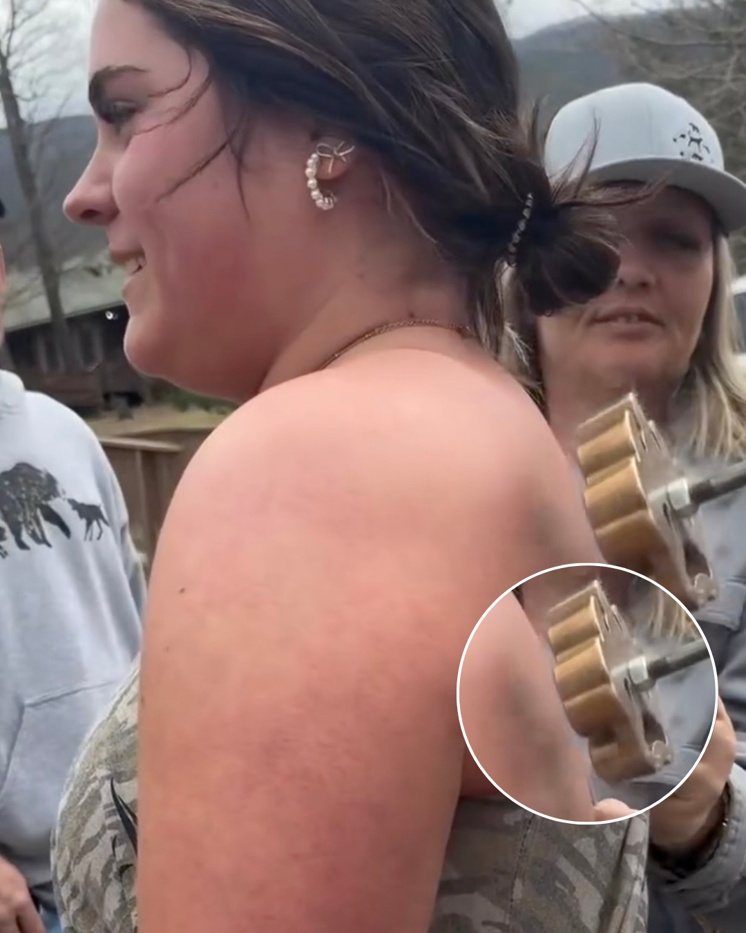 Vrouw geeft geen krimp bij het vriesmerken van haar rug…