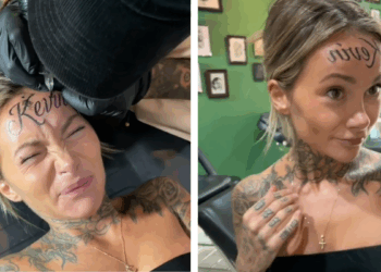 Vrouw laat naam van vriend op voorhoofd tatoeëren en wordt vervolgens gedumpt