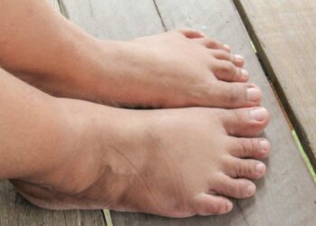 Zo ben je direct af van je dikke enkels en kuiten na een lange autorit of vlucht