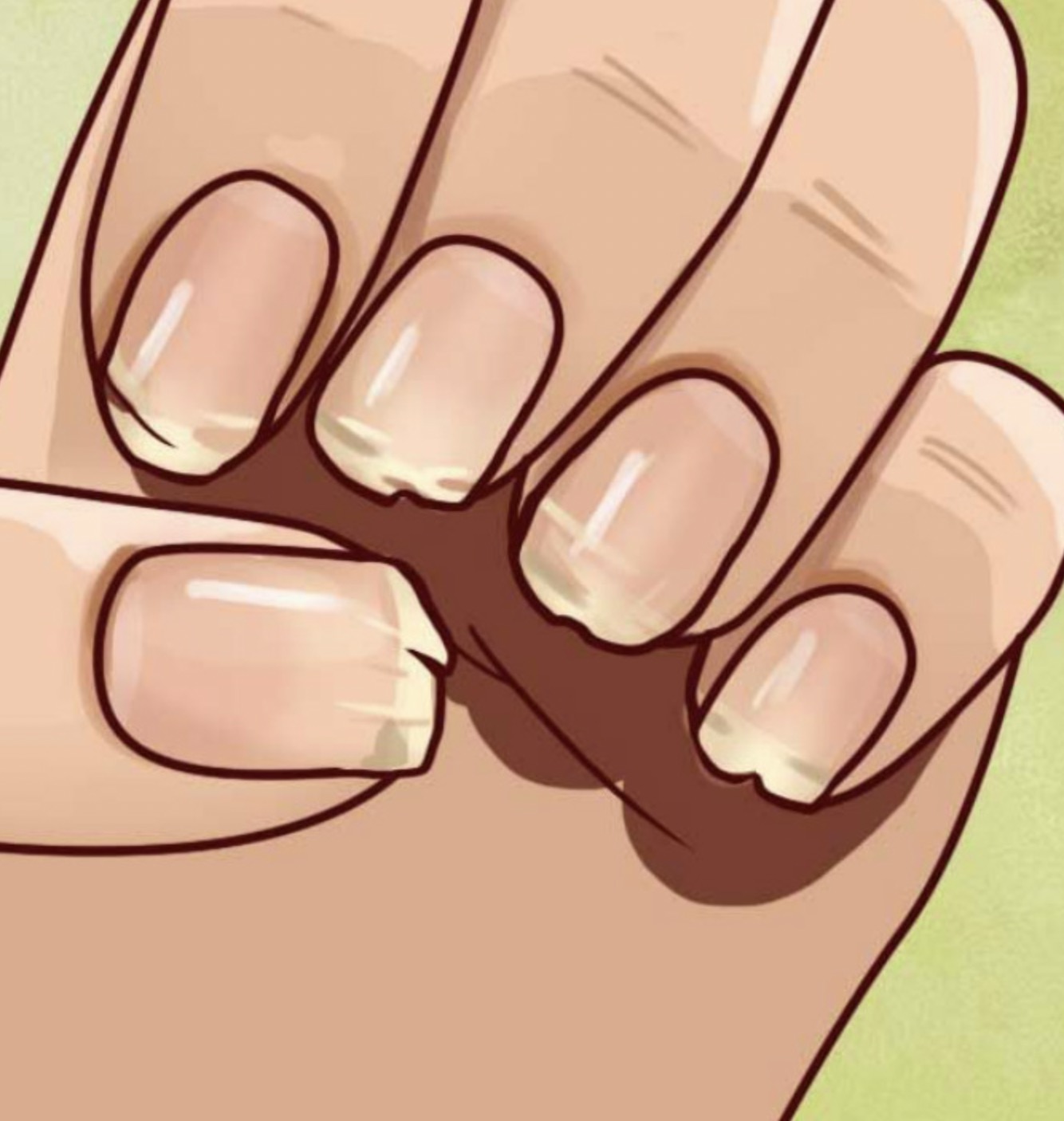 Heb je vaak last van brekende of splijtende nagels? Dit kan veel zeggen over je gezondheid