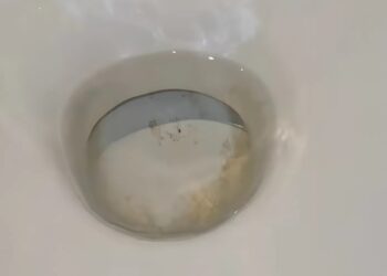 Weg met de vieze WC: Dit huishoudelijk middeltje doet wonderen!