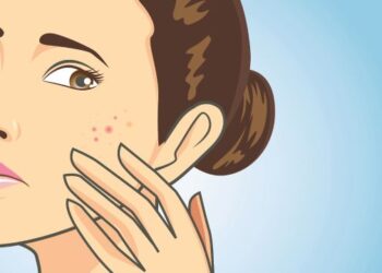 Artsen waarschuwen: waarom je nooit puistjes moet uitknijpen in de ‘dodelijke driehoek’