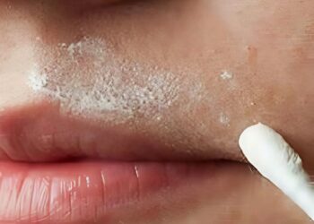 Vrouw onthult de beste manier om haartjes op je bovenlip te verwijderen zónder te scheren