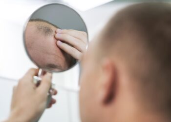 Kan je echt kaal worden van een pet? Zo zit het!